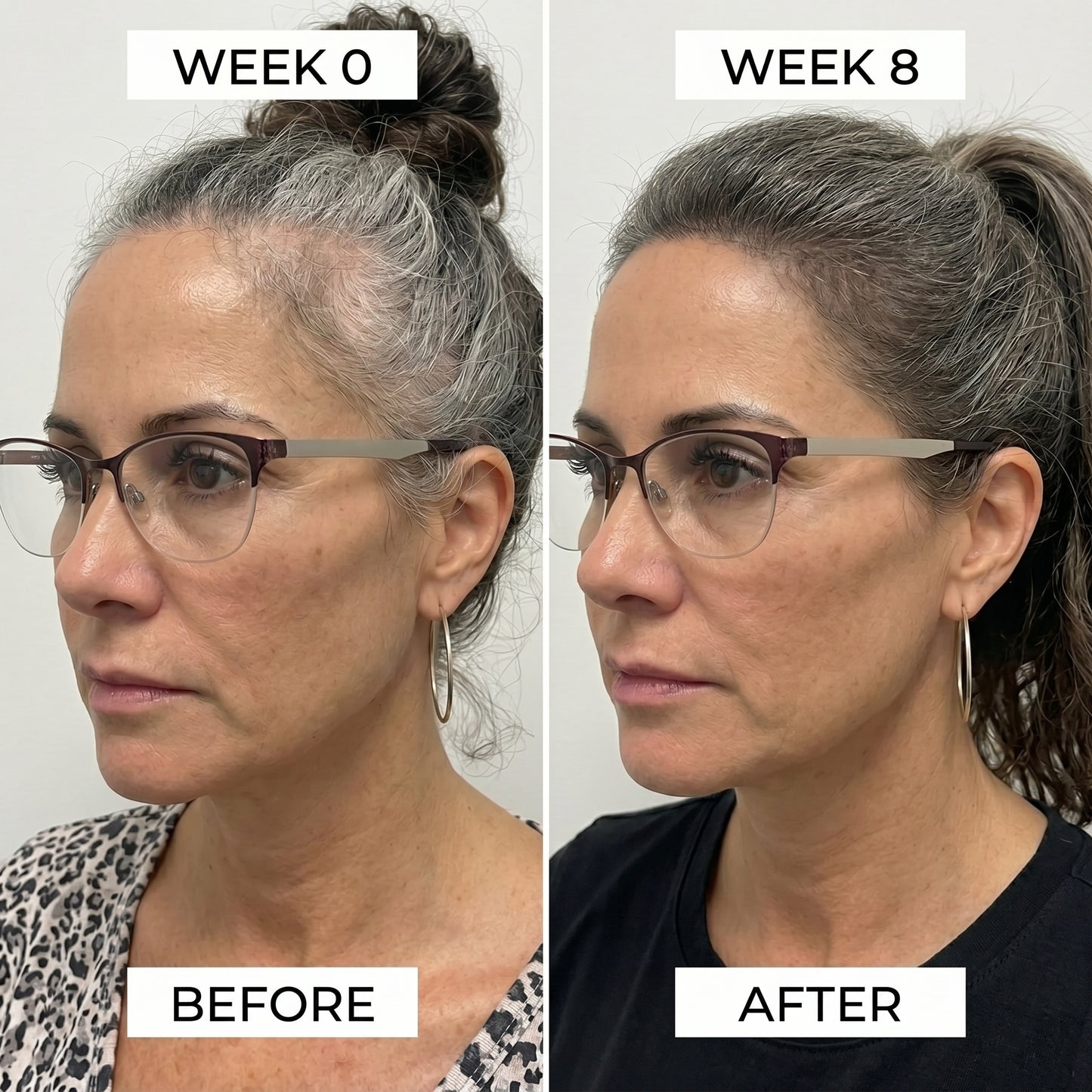 Lumara™ Scalp and Hair Care Device